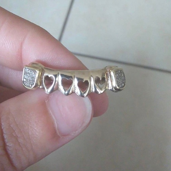Real gold authentic grillz molded to your teeth